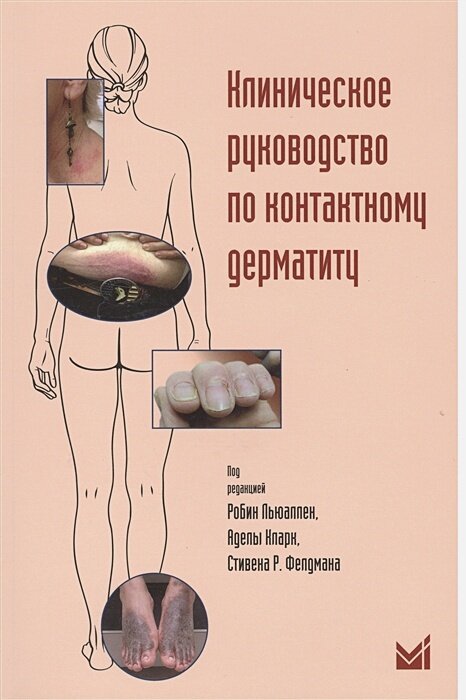 Клиническое руководство по контактному дерматиту. Диагностика и лечение в зависимости от области поражения ISBN 978-5-00030-288-0