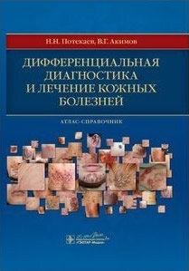 Дифференциальная диагностика кожных болезней. Атлас-справочник 2 издание справочника В.Г. Акимова