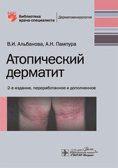 Атопический дерматит ВИ Альбановой и АН Пампуры, 2-е издание 978-5-9704-5640-8
