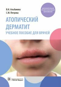 Атопический дерматит. Учебное пособие для врачей ISBN 978-5-9704-6852-4
