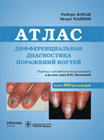 Атлас Дифференциальная диагностика поражений ногтей. М., 2011, 200 с. Обложка издания. Издательство Гэотар, Москва 2011