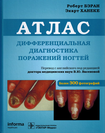 Дифференциальная диагностика поражений ногтей Атлас Робера Барана и Экарта Ханеке. ISBN 978-5-9704-5131-1