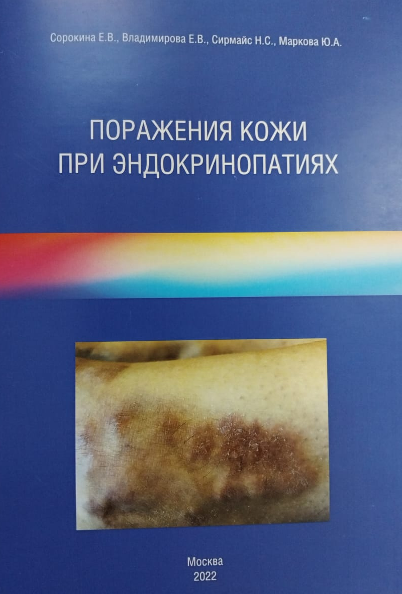 Кожные появления эндокринопатий Пособие для вроачей авторов Сорокиной Е.В., Владимировой Е.В., Сирмайс Н.С., Марковой Ю.А.