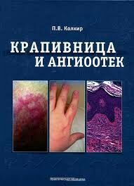 Крапивница и ангиоотек ISBN 978-5-98811-225-9 978-5-98811-225-9