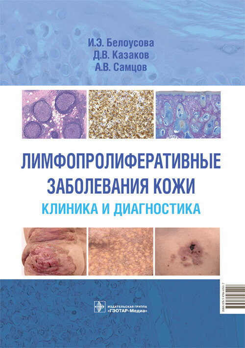 Лимфопролиферативные заболевания кожи. Клиника и диагностика 978-5-9704-6541-7