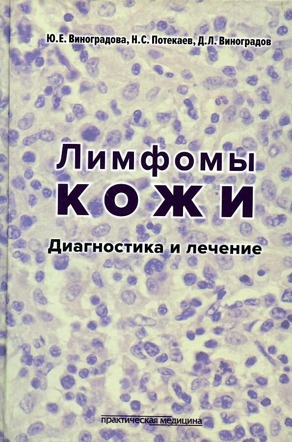Лимфомы кожи: диагностика и лечение ISBN: 978-5-98811-256-3
