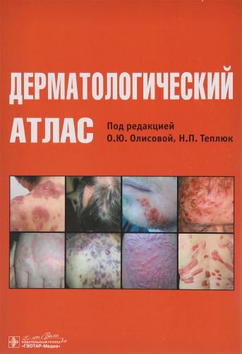 Дерматологический атлас О.Ю. Олисовой и Н.П. Теплюк 978-5-9704-3482-6