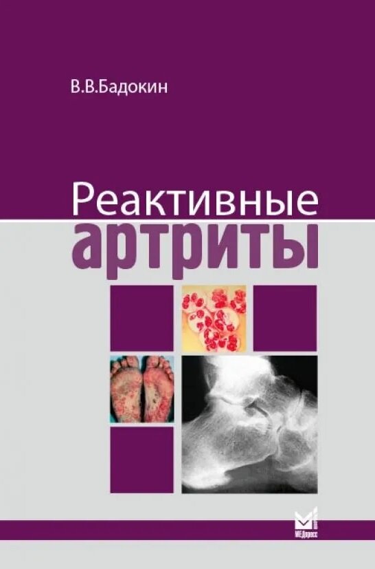 Реактивные артриты. Урогенитальные и постэнтероколитические ISBN 978-5-000-30988-9