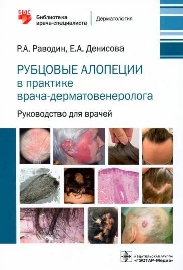 Рубцовые алопеции в практике врача-дерматовенеролога. Руководство для врачей 978-5-9704-6289-8