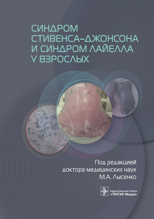 Синдром Стивенса–Джонсона и синдром Лайелла у взрослых. Под ред. М.А. Лысенко ISBN: 978-5-9704-7663-5