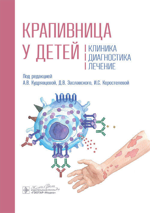 Крапивница у детей. Клиника, диагностика, лечение Крапивница у детей. Клиника, диагностика, лечение